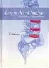 HERNIA DISCAL LUMBAR